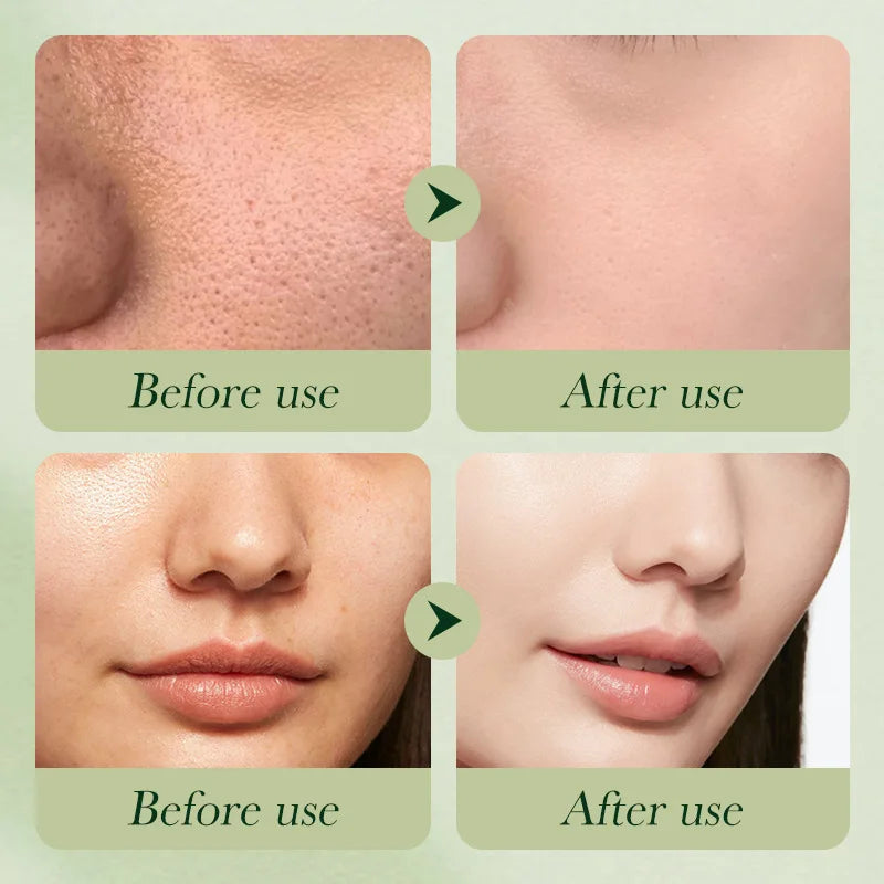 Skin Care Sets Cream